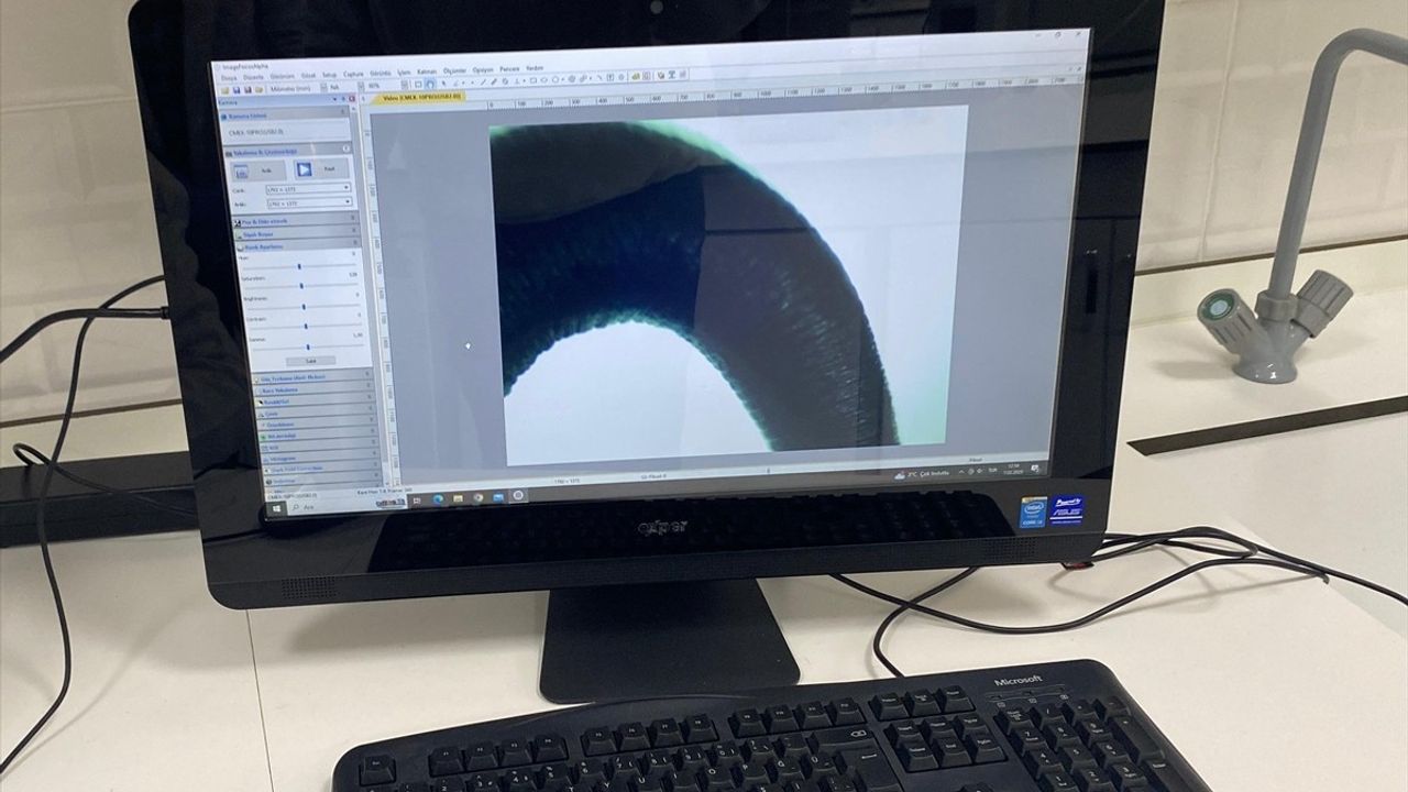 Sülük Salgısının Alternatif Tıptaki Rolü: İltihaplı Hastalıklara Yeni Umut