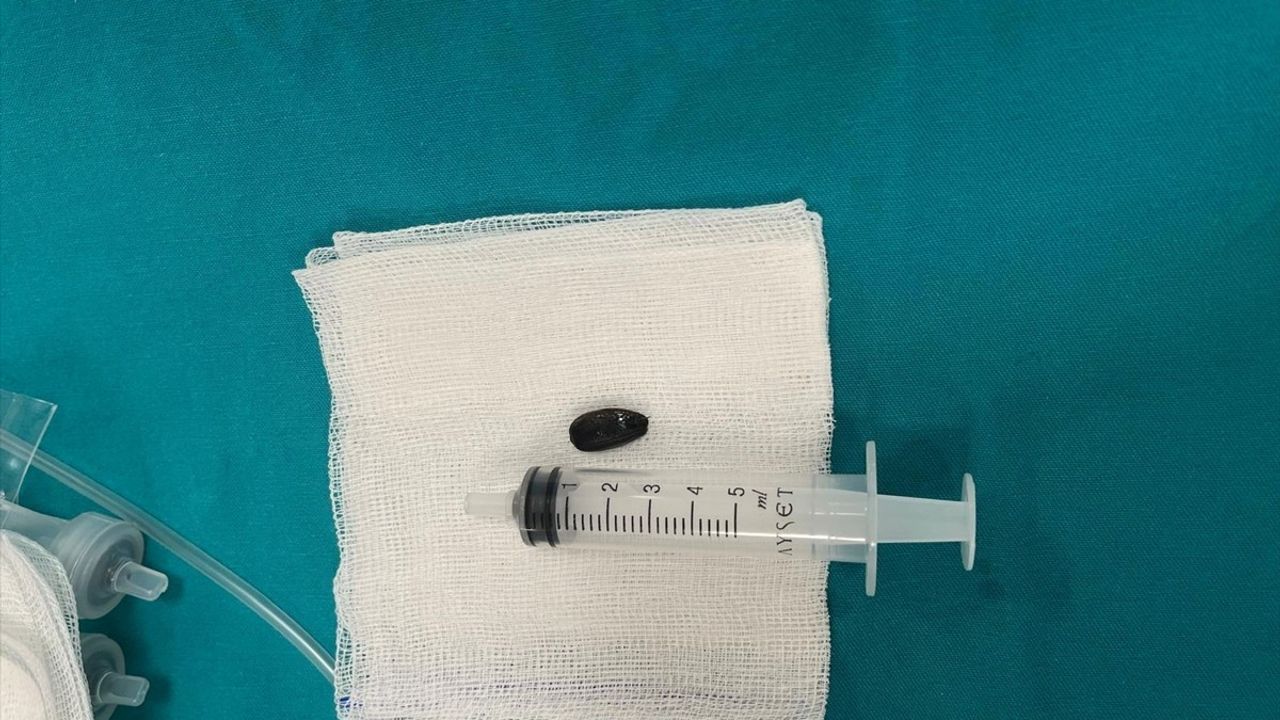 Batman'da 15 Aylık Bebek Akciğerindeki Çekirdek Kabuğuna Kavuştu