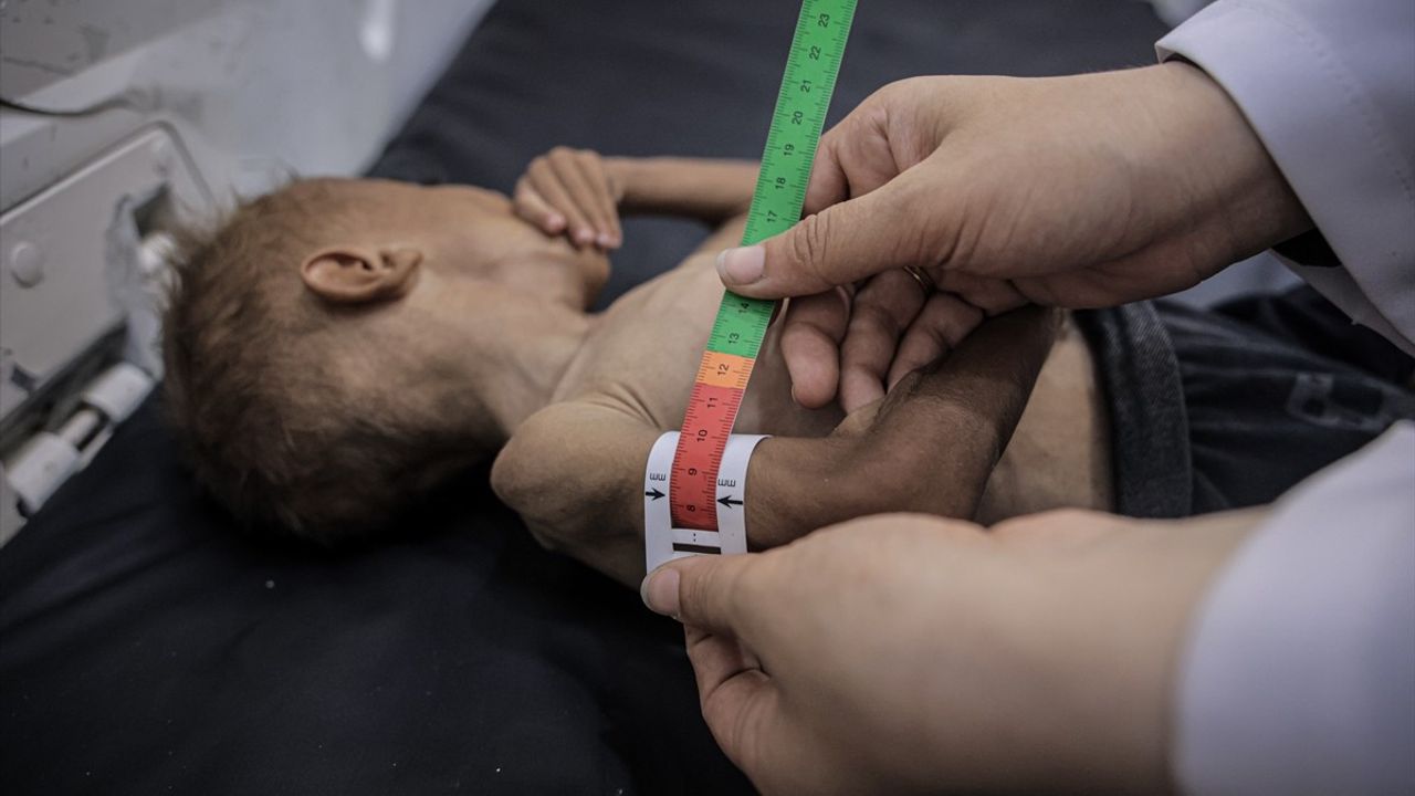 Gazze Şeridi'nde Açlıkla Mücadele: Doktor Gerçekleri Ortaya Koydu