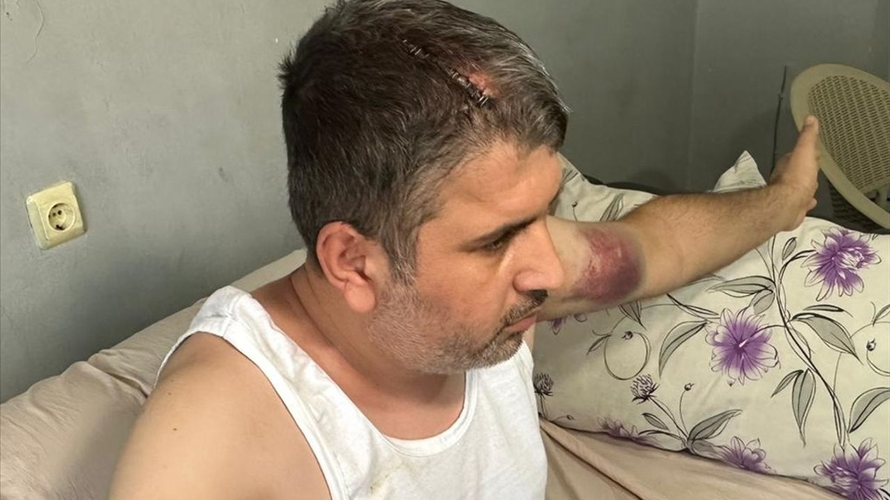 Adana'da Miras Kavgası İçin Dayısından Beyzbol Sopasıyla Darbe Alan Kişi Yaralandı