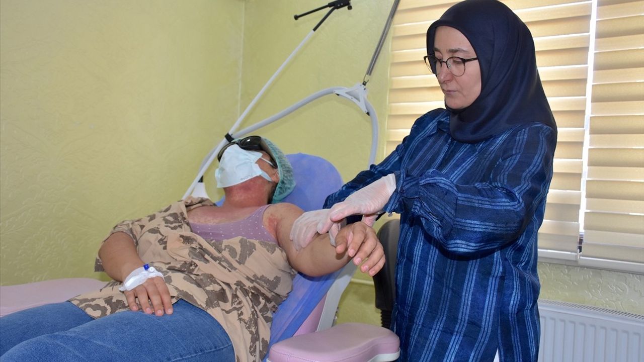 Van'da Yan Etkileriyle Tehlike Yaratan Krem Vakaları