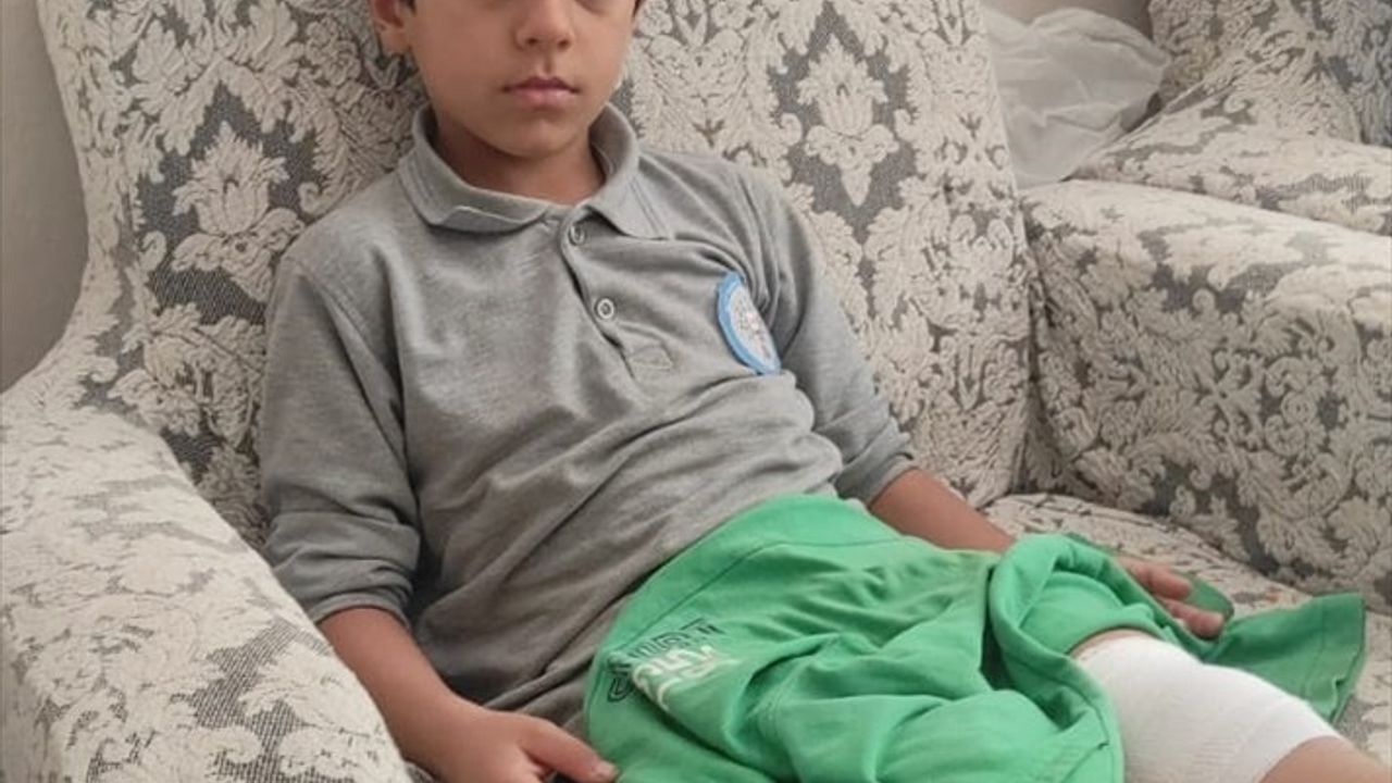 Bursa'da Sahipsiz Köpeğin Saldırısında Çocuk Yaralandı