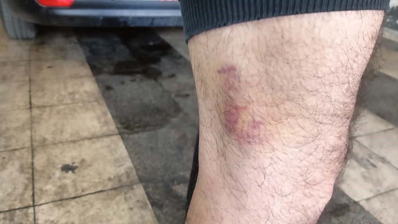 Altındağ'da 3 yaşındaki oğlunun önünde darp edildi, kolu kırıldı