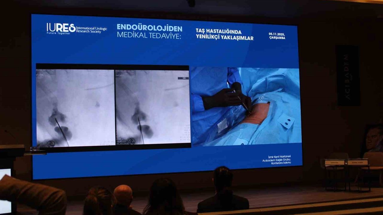 Endoürolojide Lazer ve Robotikle Gelen Değişim