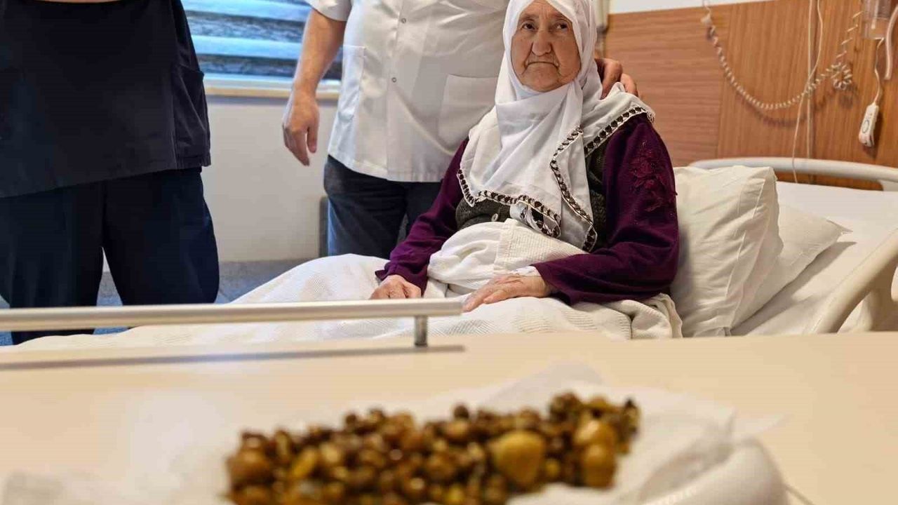 İnegöl'de 77 yaşındaki kadının safra kesesinden 213 taş çıkarıldı