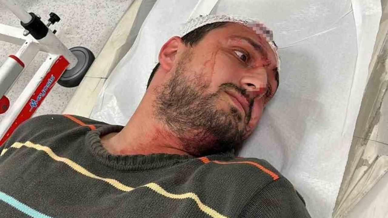 İzmit’te vicdanları yaralayan iddia: Otizmli yetişkine odunla saldırı