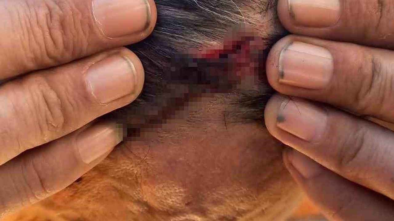 Kartal'da taksimetre kavgası: Şoför başından yaralandı