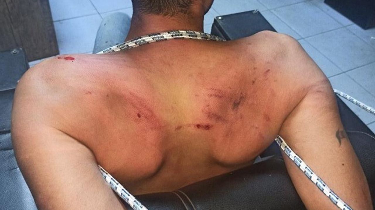 Antalya’da hamam böceği yedirilen genç davasında karar: Yağmadan beraat, hürriyeti yoksun kılmaktan hapis