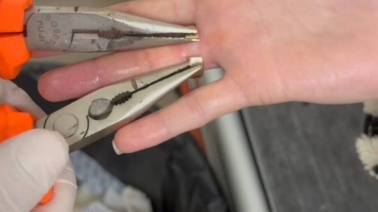 Batman'da parmağa sıkışan iki yüzük itfaiye tarafından spiral makineyle çıkarıldı