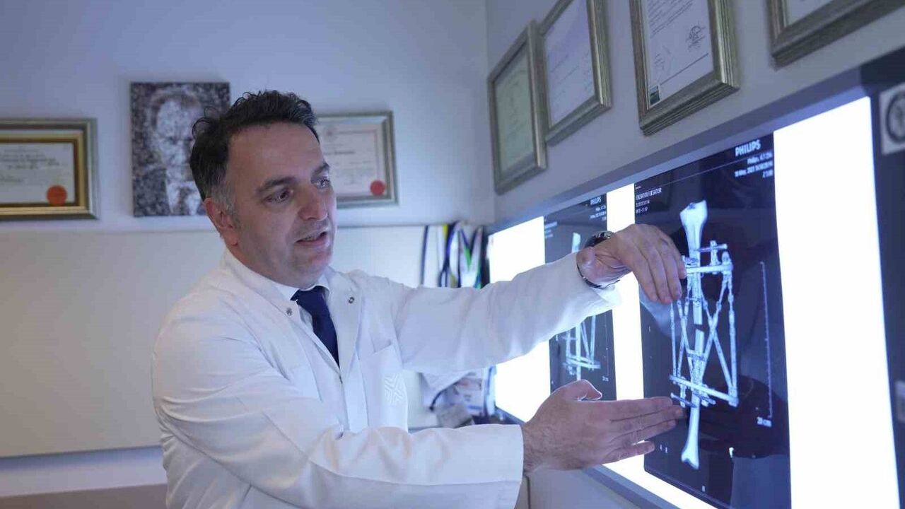 Boy kısalığına modern çözüm: Prof. Dr. Adnan Kara ile kemik uzatma yöntemleri
