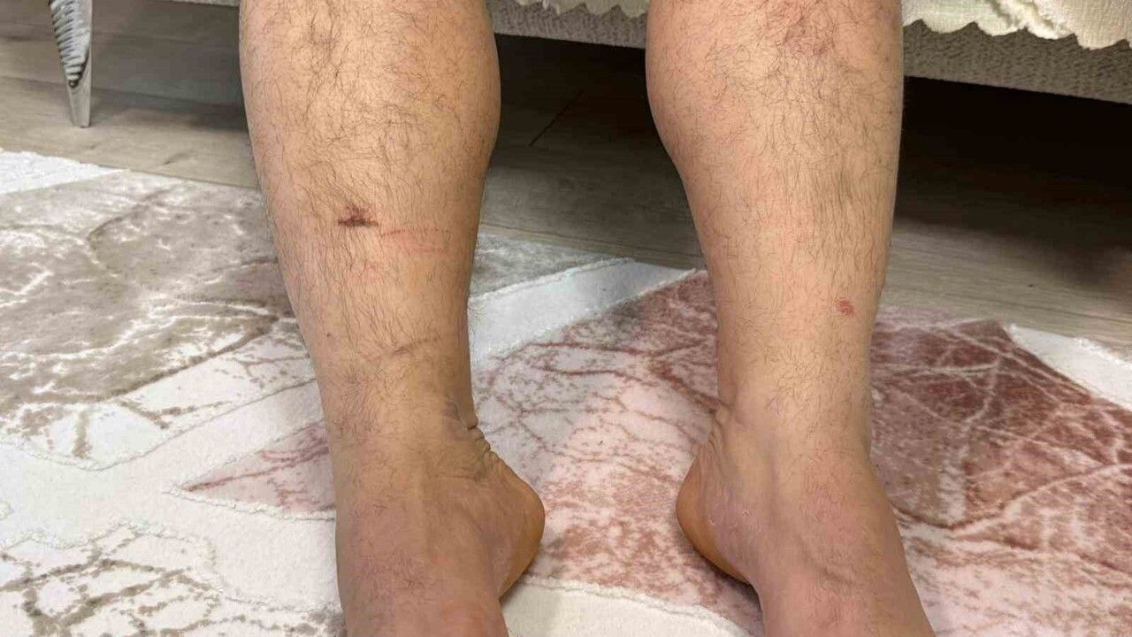 Diyarbakır'da Kaçırıldığını İddia Eden Murat Hilez: Anlattıkları Şok Etti