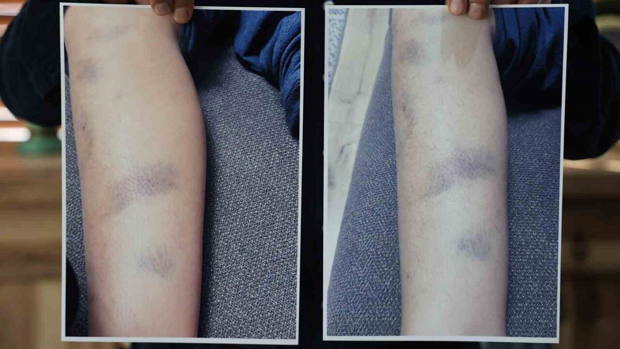 Diyarbakır’da özel okulda 8 yaşındaki öğrencinin darbedildiği iddiası