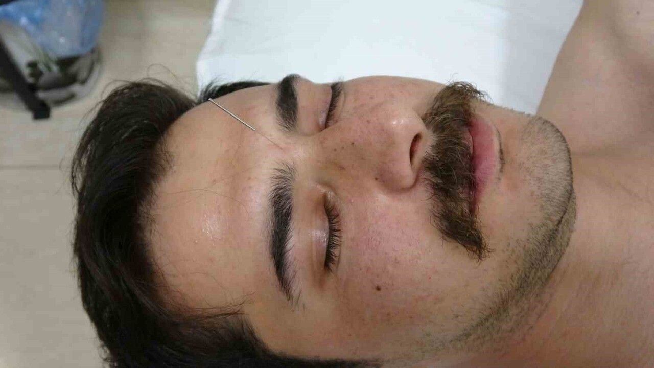 Gaziantep’te aile hekimliğinde akupunkturla iyileşen hastalar