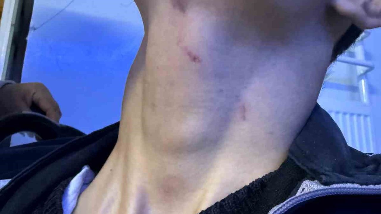 Gaziantep'te engelli bakım merkezinde darp iddiası: Genç başına 6 dikiş