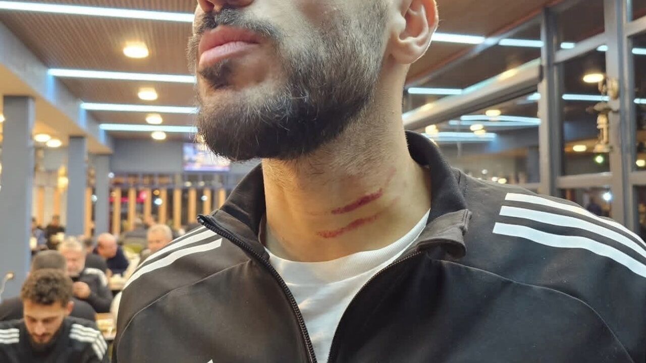 Mazıdağı Fosfatspor’dan hakem kararları ve tehlikeli müdahaleye sert tepki