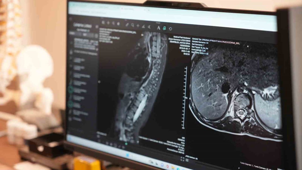 Skolyozda erken tanı ve yaşa göre tedavi yaklaşımları