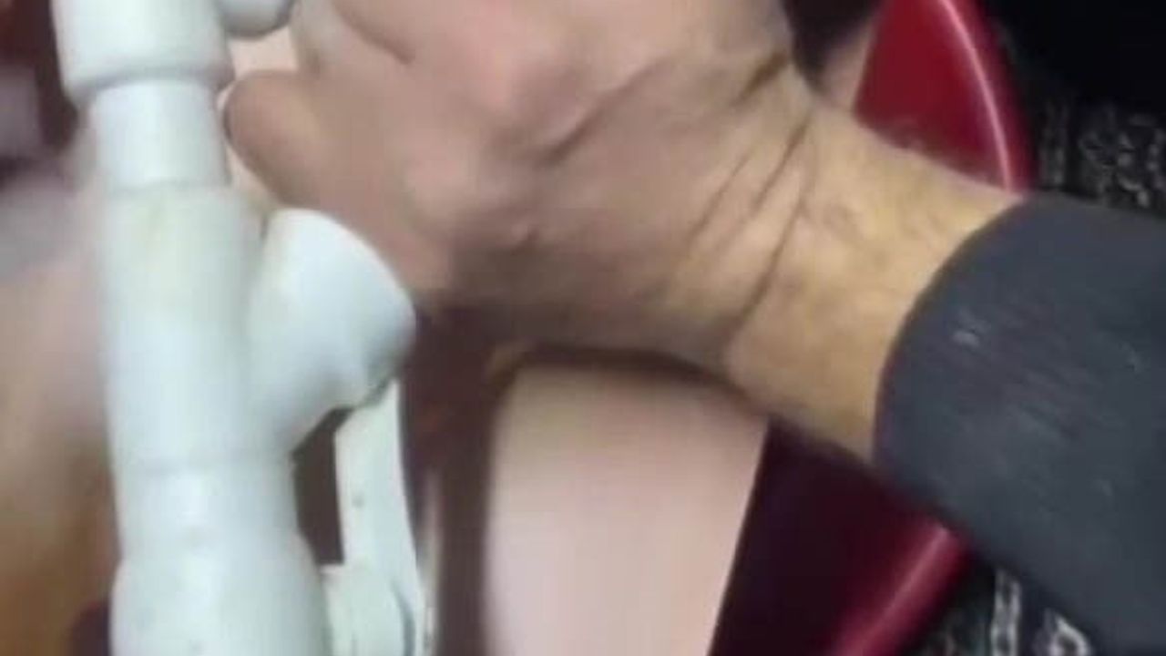 Adana'da parmak kombi borusuna sıkıştı — Cankur kurtardı