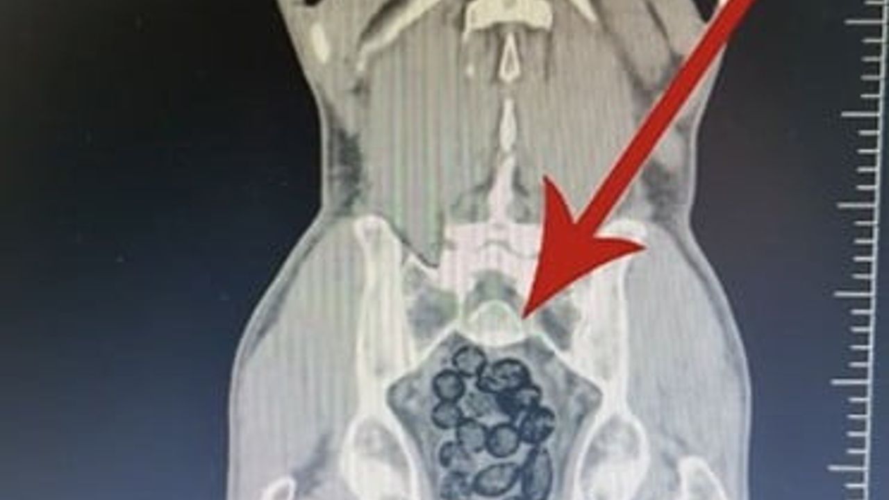 Batman'da otobüs aramasında midesinden 64 parça metamfetamin çıkan yolcu tutuklandı