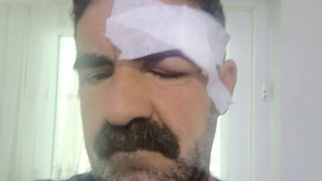 Elazığ Karakoçan’da yolcu otobüsü ile esnaf arasında tuvalet tartışması kavgaya dönüştü