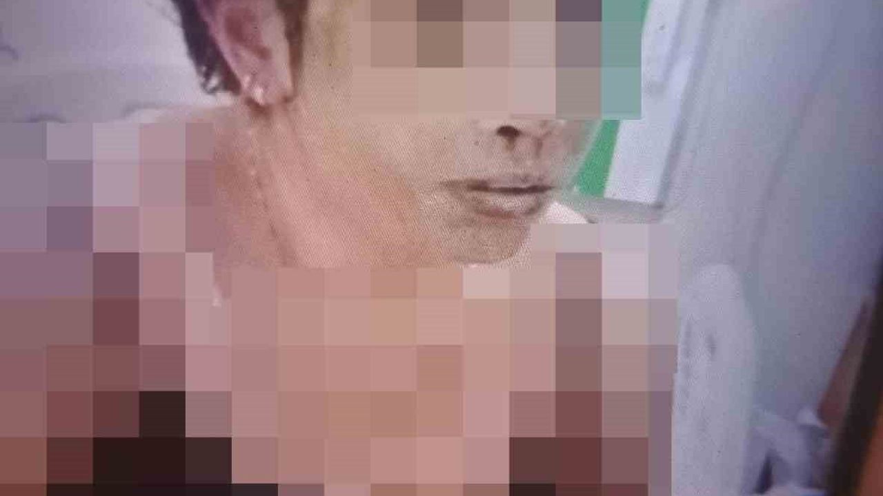 Gaziantep'te kezzaplı saldırı: Eski eş tutuklandı