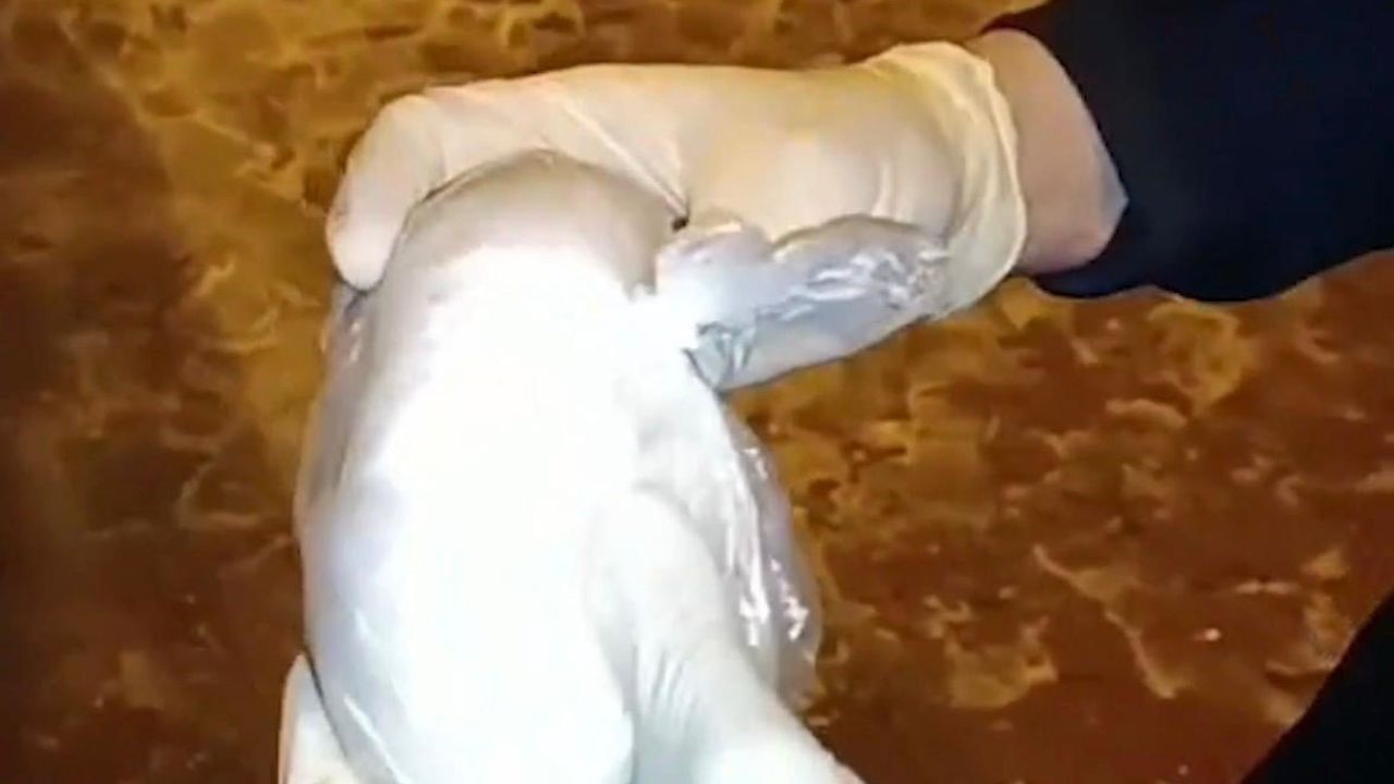 Kayseri'de 'torbacı' operasyonu: 1 gözaltı, 450 gram ele geçirildi