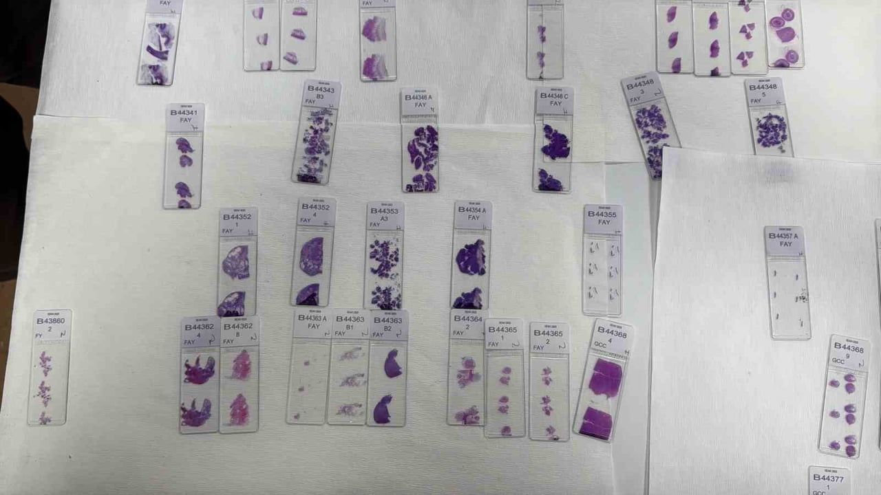 Patologlar: Tıbbın son tanısını veren hakimleri