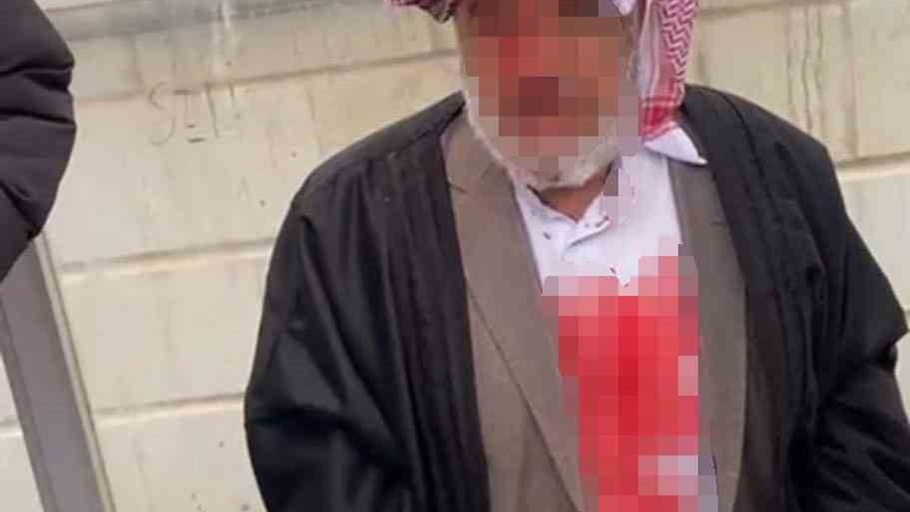 Şanlıurfa Viranşehir’de 72 Yaşındaki Adam Sopalarla Darp Edildi, 4 Şüpheli Tutuklandı