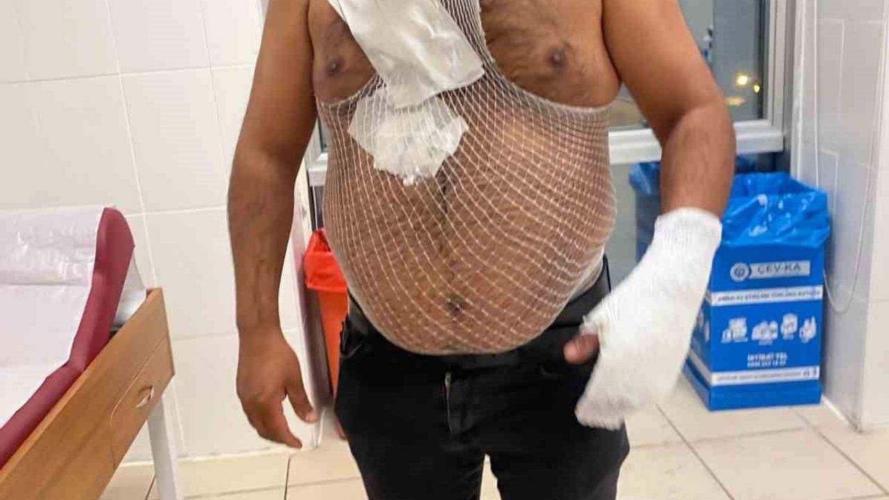 Sivas'ta meşhur tostçu Raşit Yıldırım, sıcak su denemesinde yanıklarla hastaneye kaldırıldı