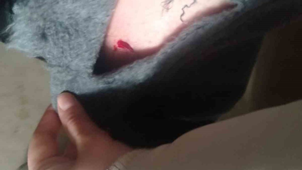 Tomarza'da sokak köpeği saldırısı: kız çocuğu bacağından yaralandı