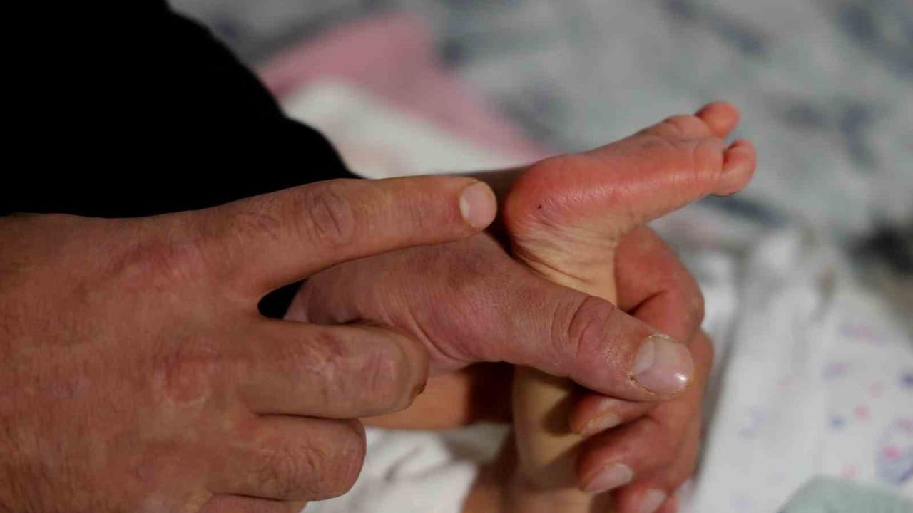 Topuk kanı krizi: Adana çiftinin bebeğine kayyum endişesi