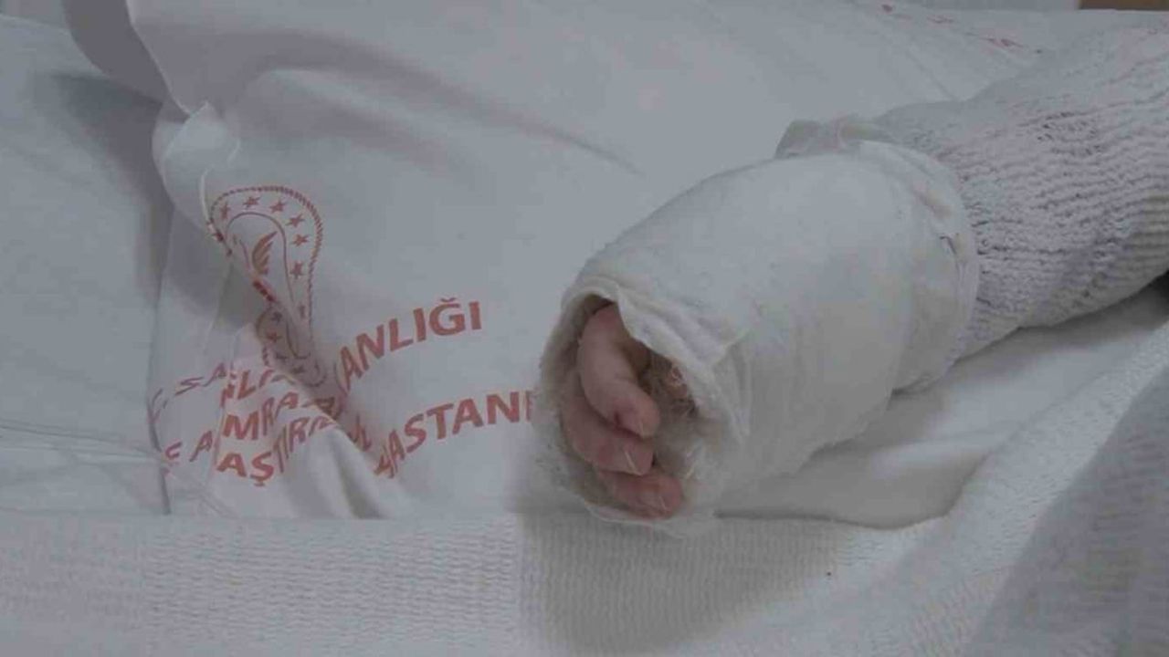 İstanbul'da 20 aylık bebeğe kaynar su döküldü: vücudunun yüzde 27'si yandı
