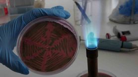 Çiğ süt çalışması: E. coli, UPEC genleri ve antibiyotik direnci tehdidi