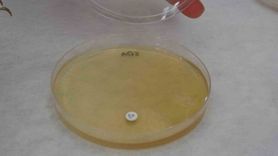 Endemik Malatya kantaronu, sarı kantarondan daha zengin çıktı