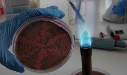 Çiğ süt çalışması: E. coli, UPEC genleri ve antibiyotik direnci tehdidi
