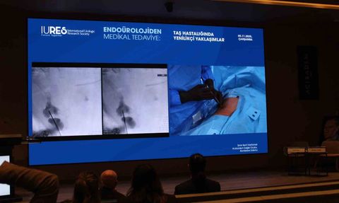 Endoürolojide Lazer ve Robotikle Gelen Değişim