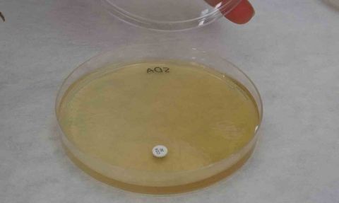 Endemik Malatya kantaronu, sarı kantarondan daha zengin çıktı