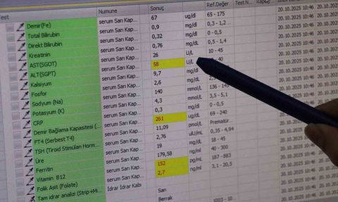 Enerji içecekleri ve fast food çocuklarda karaciğer yağlanmasını artırıyor