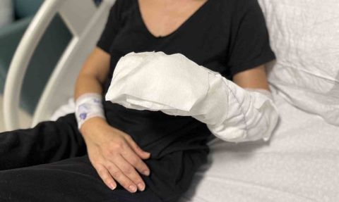 İstanbul'da dekoratif şömine patladı: Vücudunun yüzde 30'u yandı