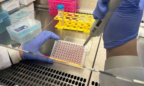 Parkinson araştırmasında bağırsak‑beyin iletişimi çip üstü organlarla modelleniyor