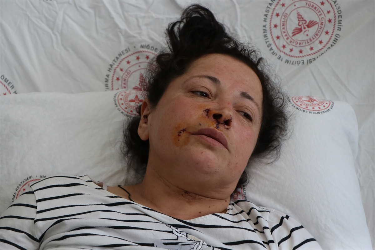 Niğde'de sahipli 2 köpeğin saldırısında yaralanan kadın, tedavi altına alındı. Altunhisar...