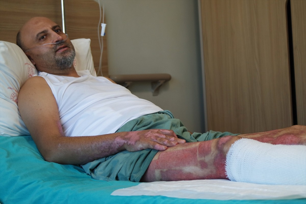 Bursa'da mangal jeliyle semaveri tutuşturmaya çalışan 48 yaşındaki Necdet Özdemir, jelin alev...