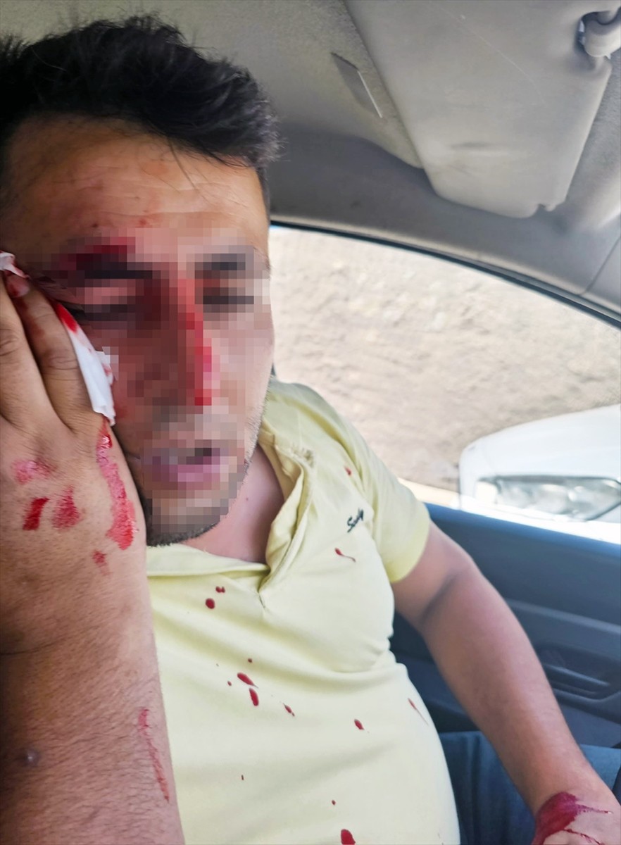 Dicle Elektrik, Şırnak'ın Cizre ilçesinde kaçak elektrik kontrolü yapmaya çalışan 1 çalışanının...