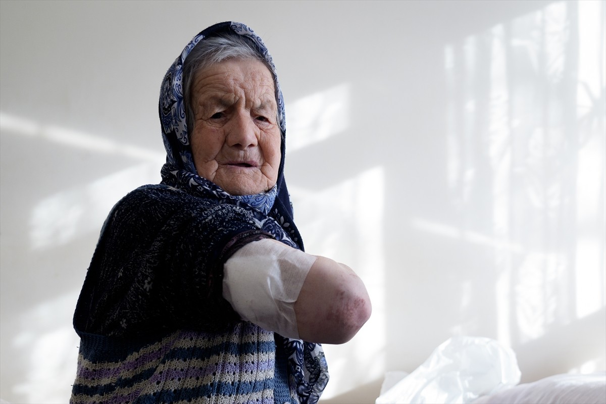 Ankara'da yaşlı bir kadın, sahipsiz sokak köpeğinin saldırısı sonucu kolundan yaralandı. Mamak...