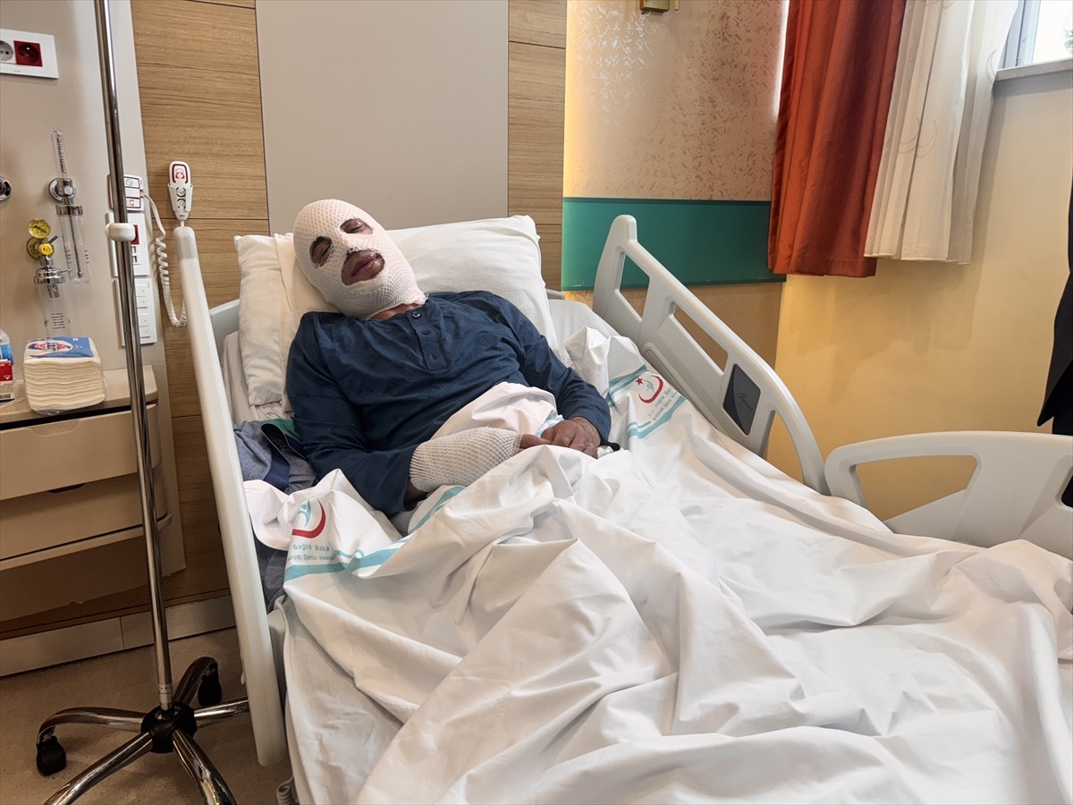 Erzurum'da soğuktan donduğunu düşündüğü için ocakta ısıttığı sprey boya tüpünün patlaması sonucu...