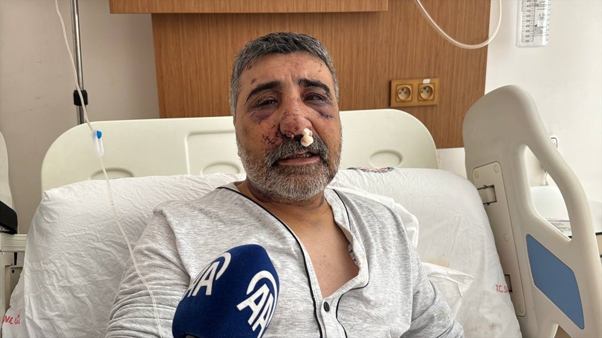 İstanbul Havalimanı'ndan aracına binen İngiltere uyruklu boksör R.K. tarafından darbedilen ve ağır...