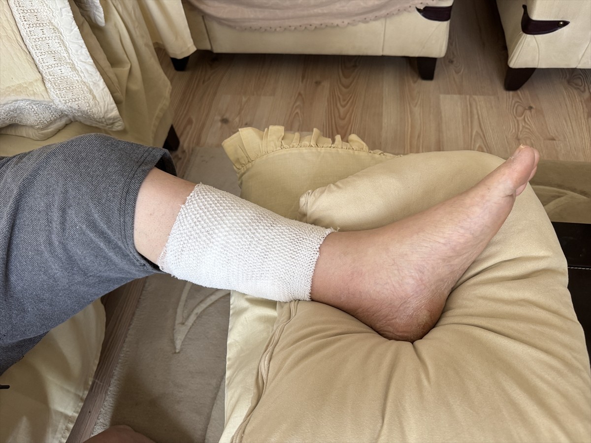 Aksaray Belediyesi sınırlarında 4 sahipsiz köpeğin saldırısına uğrayan Cafer Bilinçli (64)...