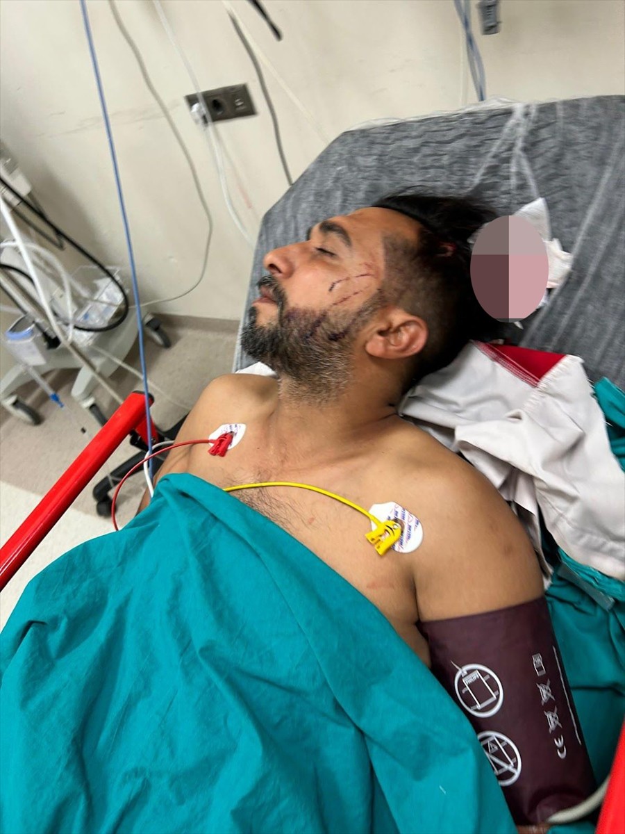 Adana'da döner ustası Ramazan Malgir (fotoğrafta), iş yerinde çalıştığı sırada metal tavanı delen...