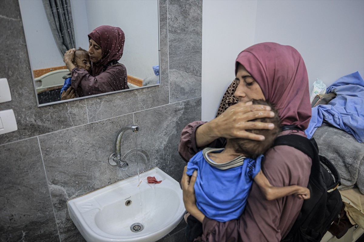 İsrail’in açlıktan zayıfladığını inkar ettiği 1,5 yaşındaki Filistinli Muhammed Zekeriya Eyyub...