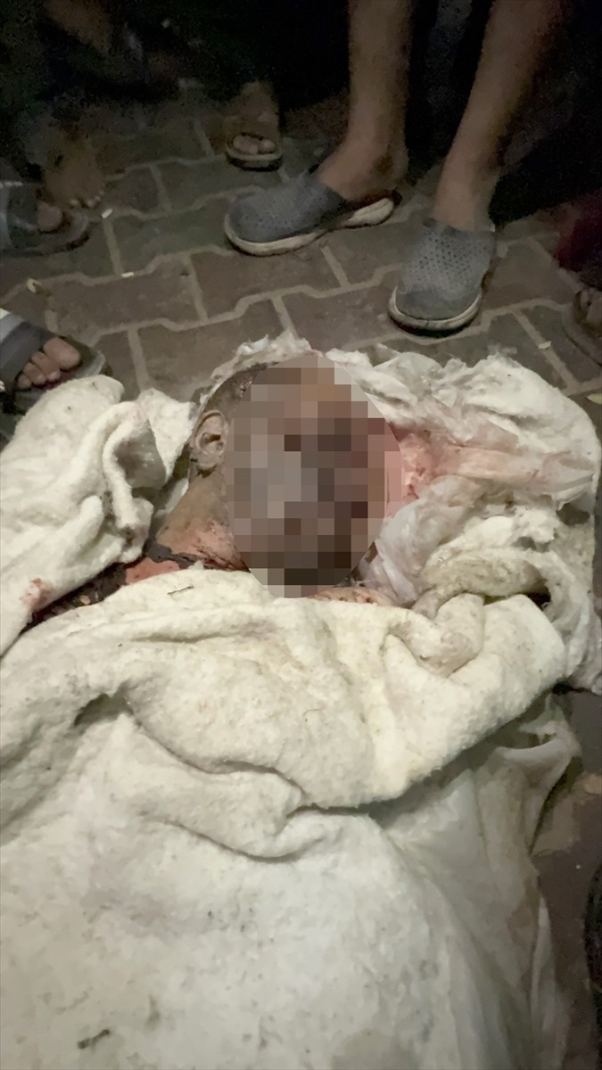 İsrail ordusunun, Şifa Hastanesi çevresinde gazetecilerin çadırına düzenlediği saldırıda Katar...