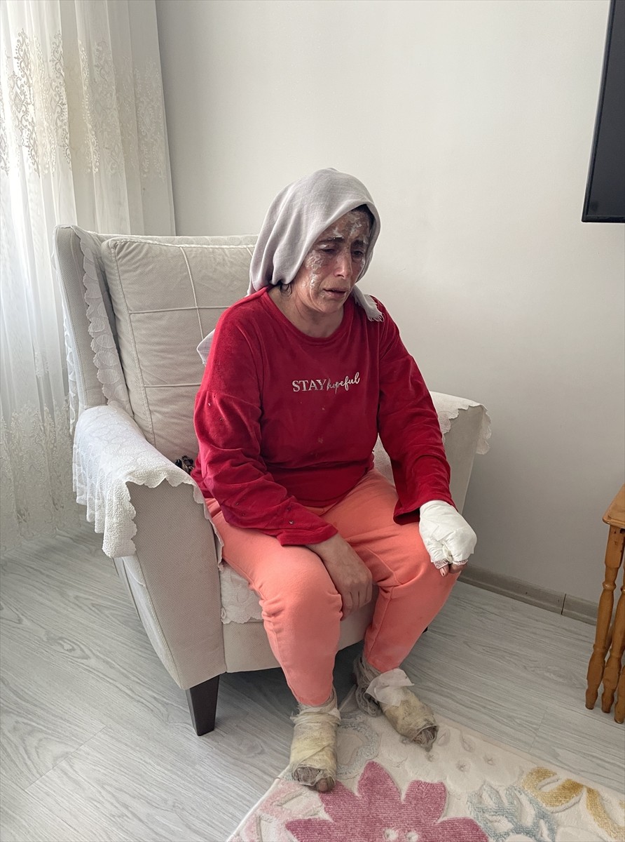 Bursa'nın Karacabey ilçesinde biri çocuk 3 kişinin hayatını kaybettiği yangında yaralanan Kifayet...